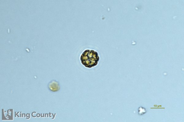 Photo of Heterosigma akashiwo